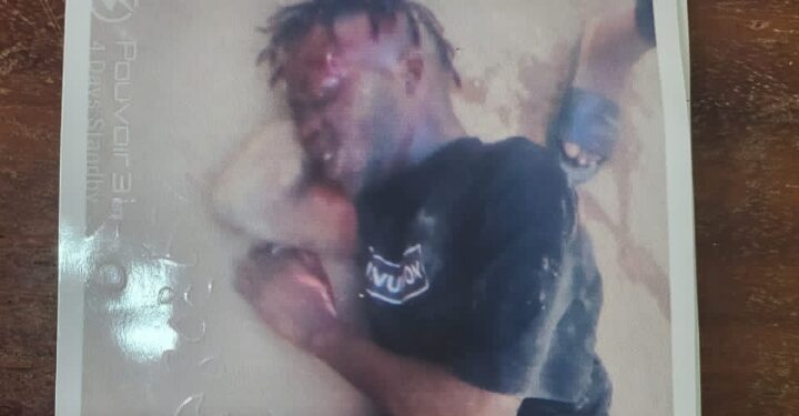 A pix of an Unidentified Unclaimed Male Corpse