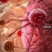 Cancer Experts Report Major Breakthroughs